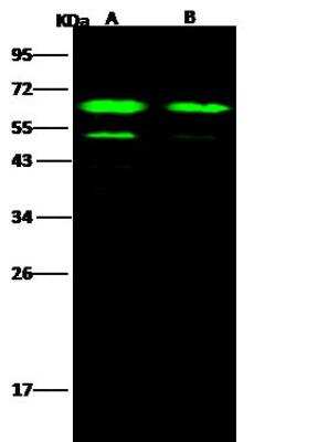 Western Blot: EBOV GP Antibody [NBP3-12732]