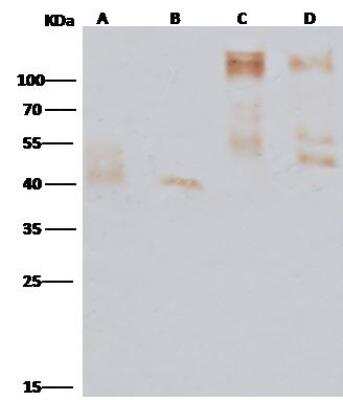 Western Blot: EBOV GP Antibody [NBP3-12747]