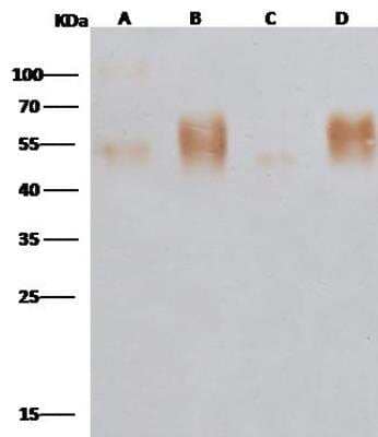 Western Blot: EBOV GP Antibody [NBP3-12748]