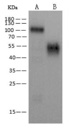 Western Blot: EBOV GP Antibody [NBP3-12758]