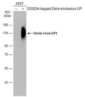 Western Blot: EBOV GP1 Antibody [NBP3-13370]