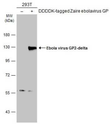 Western Blot: EBOV GP2-delta Antibody [NBP3-13371]