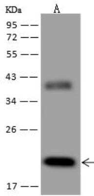 Western Blot: EBOV Nucleoprotein Antibody (09) [NBP3-12759]