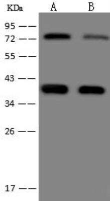 Western Blot: EBOV VP40 protein Antibody (02) [NBP3-12761]