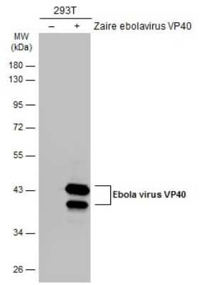 Western Blot: EBOV VP40 protein Antibody [NBP3-13342]