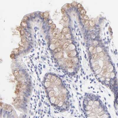 Immunohistochemistry-Paraffin: EBP Antibody [NBP1-85699]