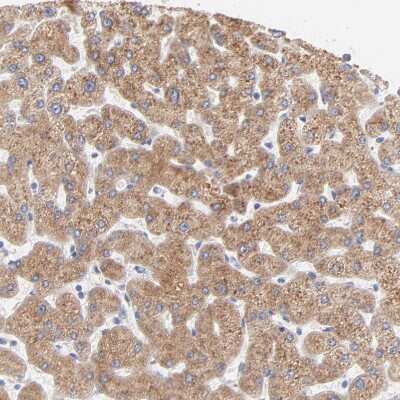 Immunohistochemistry-Paraffin: EBP Antibody [NBP1-85699]