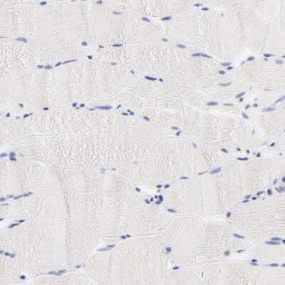 Immunohistochemistry-Paraffin: EBP Antibody [NBP1-85699]