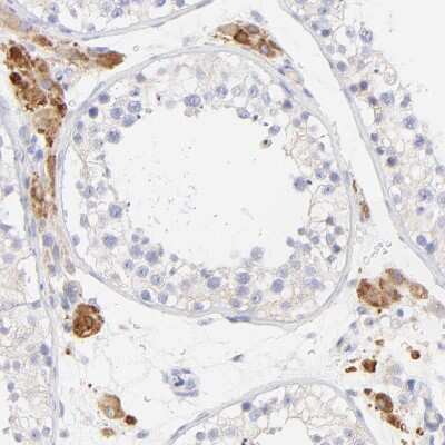 Immunohistochemistry-Paraffin: EBP Antibody [NBP1-85699]