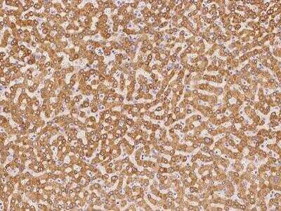 Immunohistochemistry-Paraffin: EBP Antibody [NBP3-06227]