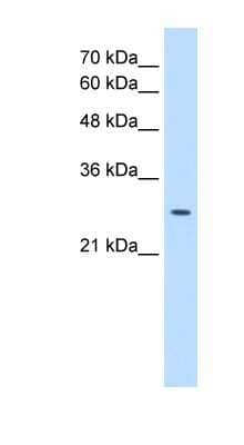 Western Blot: EBP Antibody [NBP1-59782]