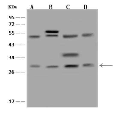 Western Blot: EBP Antibody [NBP3-06227]