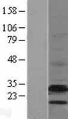 Western Blot: EBP Overexpression Lysate [NBL1-10094]