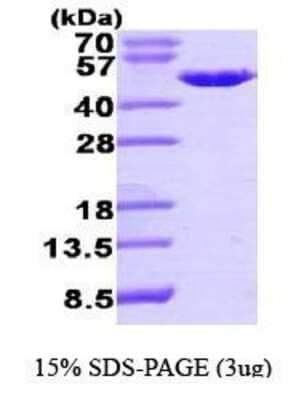 SDS-PAGE: Recombinant Human PA2G4/EBP1 His Protein [NBP1-44474]