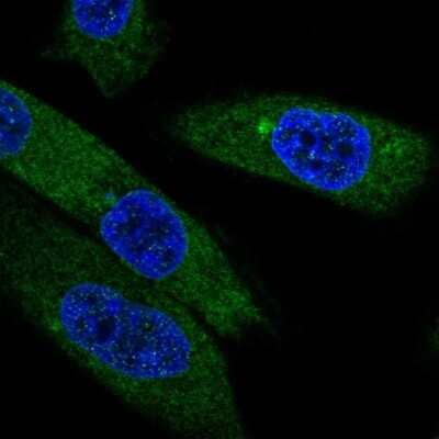 Immunocytochemistry/ Immunofluorescence: EBPL Antibody [NBP2-13943]