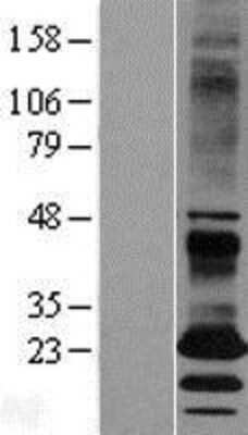 Western Blot: EBPL Overexpression Lysate [NBL1-10095]