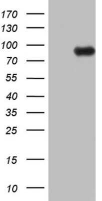 Western Blot: ECE-1 Antibody (OTI2B6) [NBP2-46482]