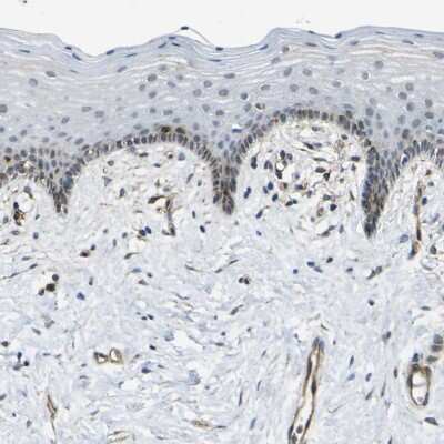 Immunohistochemistry-Paraffin: ECE-1 Antibody [NBP1-84016]