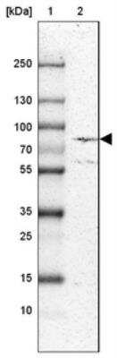 Western Blot: ECE-1 Antibody [NBP1-84017]