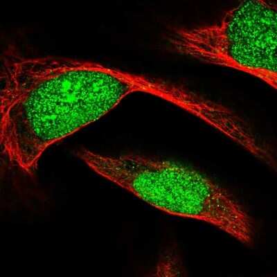 Immunocytochemistry/ Immunofluorescence: ECE-2 Antibody [NBP2-56945]