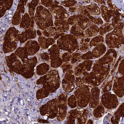 Immunohistochemistry-Paraffin: ECE-2 Antibody [NBP1-81495]