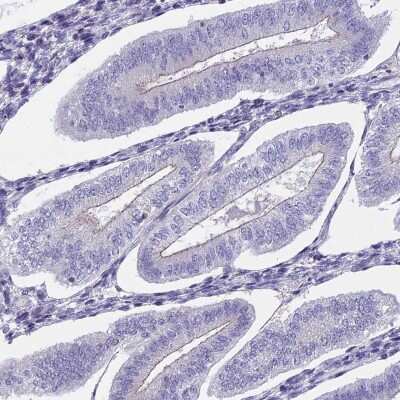 Immunohistochemistry-Paraffin: ECE-2 Antibody [NBP1-81495]