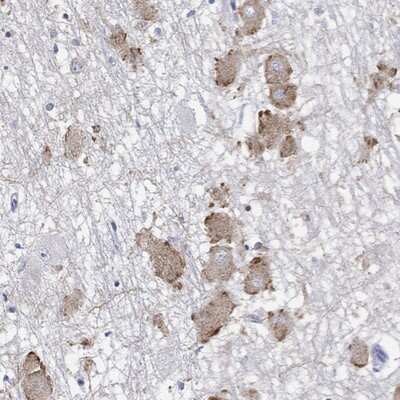 Immunohistochemistry-Paraffin: ECEL1 Antibody [NBP3-17582]