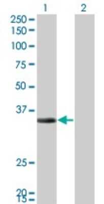 Western Blot: ECH1 Antibody (5G8) [H00001891-M01]