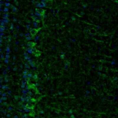 Immunohistochemistry: ECH1 Antibody [NBP1-83215]
