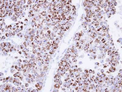 Immunohistochemistry-Paraffin: ECH1 Antibody [NBP1-31662]