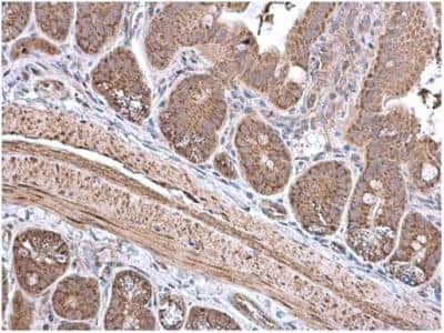 Immunohistochemistry-Paraffin: ECH1 Antibody [NBP1-31662]