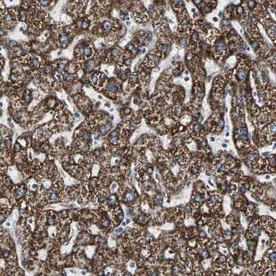 Immunohistochemistry-Paraffin: ECH1 Antibody [NBP1-83215]