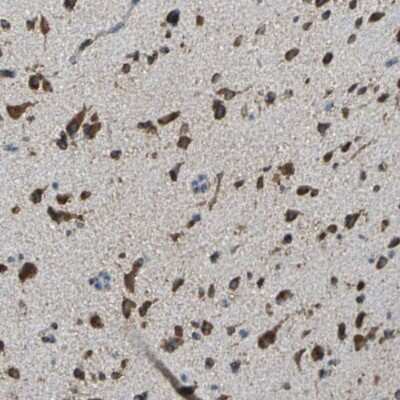 Immunohistochemistry-Paraffin: ECH1 Antibody [NBP1-83215]
