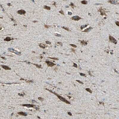 Immunohistochemistry-Paraffin: ECH1 Antibody [NBP1-83215]