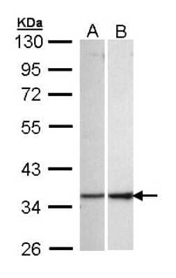 Western Blot: ECH1 Antibody [NBP1-31662]