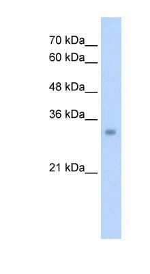 Western Blot: ECH1 Antibody [NBP1-54738]