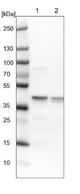 Western Blot: ECH1 Antibody [NBP1-83215]