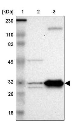 Western Blot: ECH1 Antibody [NBP1-83216]