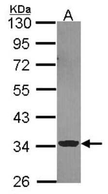 Western Blot: ECH1 Antibody [NBP2-16261]
