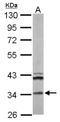 Western Blot: ECH1 Antibody [NBP2-16261]