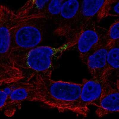 Immunocytochemistry/ Immunofluorescence: ECHDC1 Antibody [NBP2-68625]