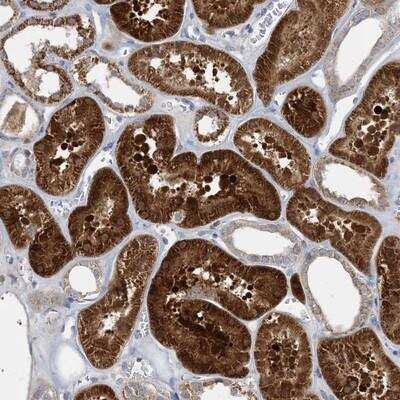 Immunohistochemistry-Paraffin: ECHDC1 Antibody [NBP1-85179]