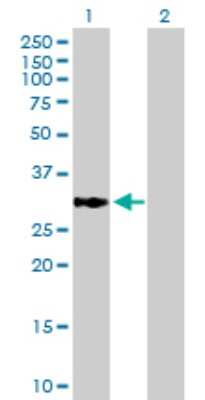 Western Blot: ECHDC1 Antibody [H00055862-B01P]