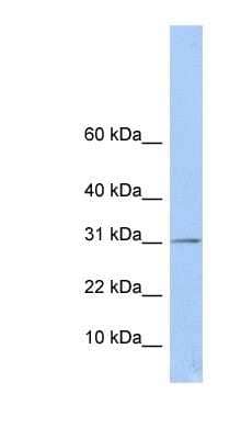 Western Blot: ECHDC1 Antibody [NBP1-53053]