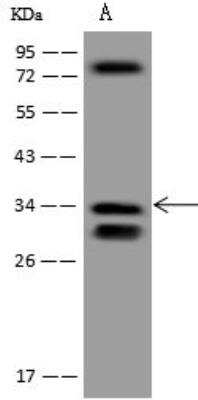 Western Blot: ECHDC1 Antibody [NBP3-12637]