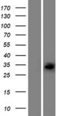 Western Blot: ECHDC1 Overexpression Lysate [NBP2-09621]