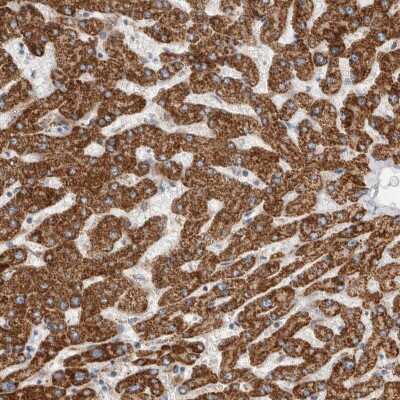Immunohistochemistry-Paraffin: ECHDC2 Antibody [NBP1-83802]