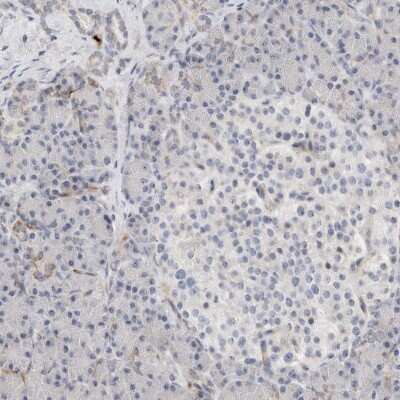 Immunohistochemistry-Paraffin: ECHDC2 Antibody [NBP1-83802]