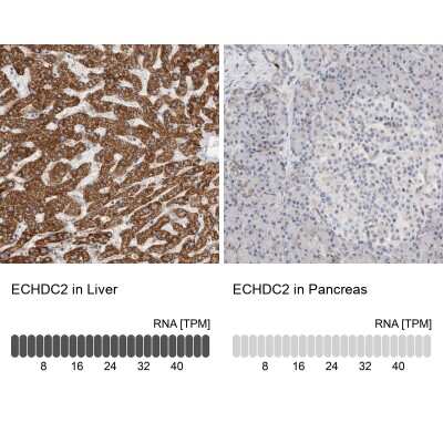 Immunohistochemistry-Paraffin: ECHDC2 Antibody [NBP1-83802]