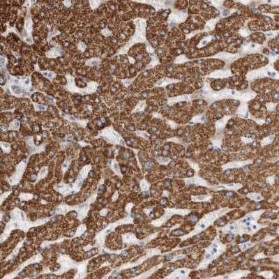 Immunohistochemistry-Paraffin: ECHDC2 Antibody [NBP1-83803]